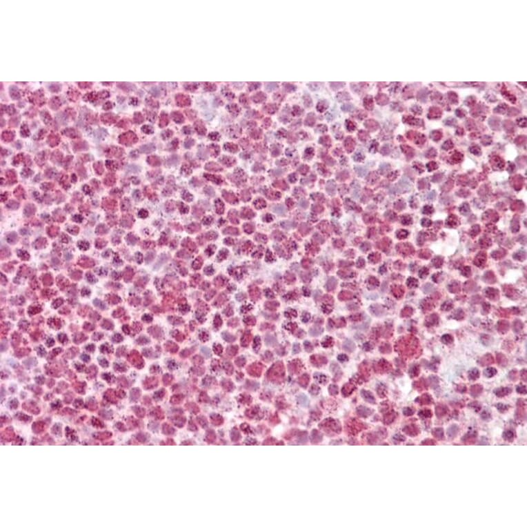 Immunohistochemistry - Anti-FBXO4/FBX4 Antibody (A286037) - Antibodies.com