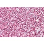 Immunohistochemistry - Anti-FBXO4/FBX4 Antibody (A286037) - Antibodies.com