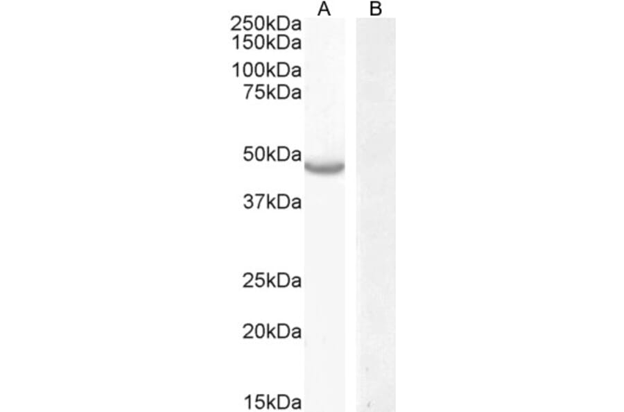 Western Blot - Anti-CETP Antibody (A286039) - Antibodies.com