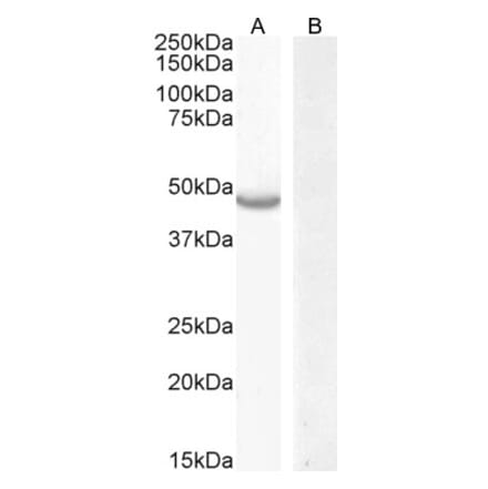 Western Blot - Anti-CETP Antibody (A286039) - Antibodies.com