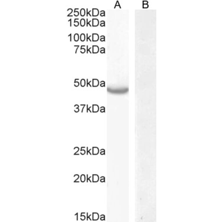 Western Blot - Anti-CETP Antibody (A286039) - Antibodies.com