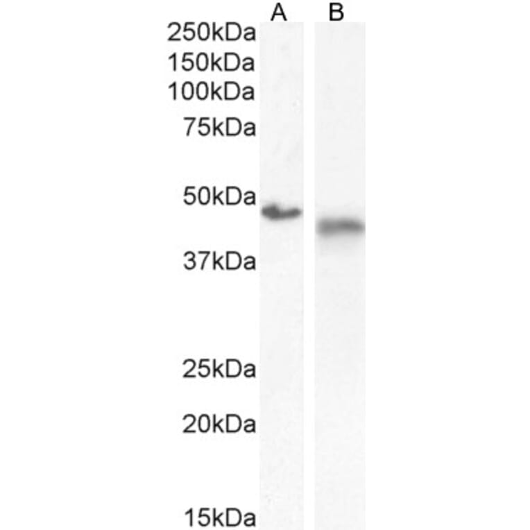 Western Blot - Anti-IL-1R-2 Antibody (A286042) - Antibodies.com