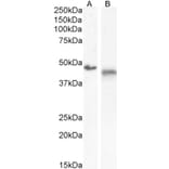 Western Blot - Anti-IL-1R-2 Antibody (A286042) - Antibodies.com