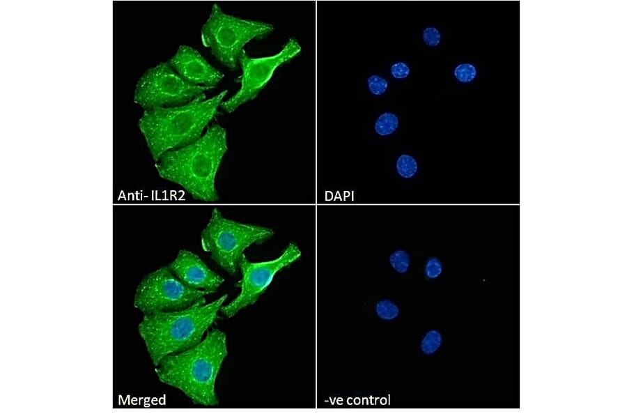 Immunofluorescence - Anti-IL-1R-2 Antibody (A286042) - Antibodies.com