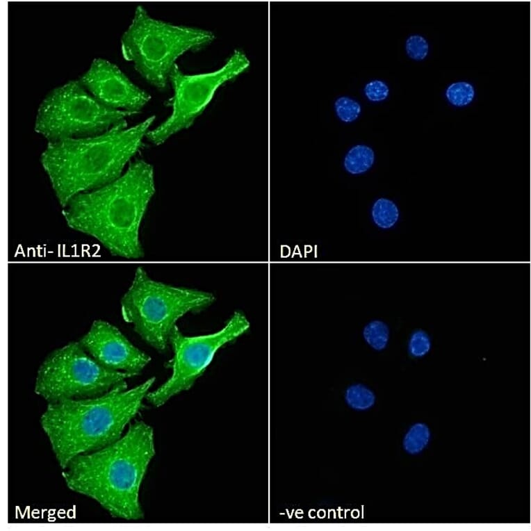 Immunofluorescence - Anti-IL-1R-2 Antibody (A286042) - Antibodies.com