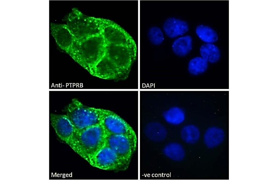 Immunofluorescence - Anti-VE-PTP Antibody (A286043) - Antibodies.com