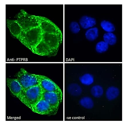 Immunofluorescence - Anti-VE-PTP Antibody (A286043) - Antibodies.com