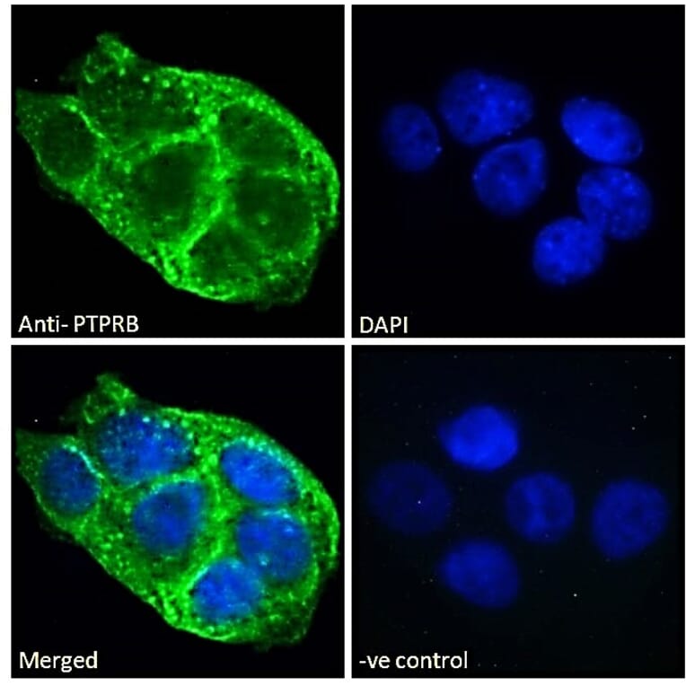 Immunofluorescence - Anti-VE-PTP Antibody (A286043) - Antibodies.com