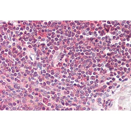 Immunohistochemistry - Anti-PINCH-2 Antibody (A286049) - Antibodies.com