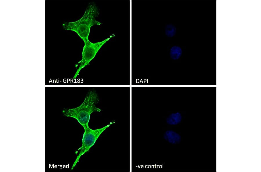 Immunofluorescence - Anti-EBV Induced Gene 2/EBI2 Antibody (A286051) - Antibodies.com