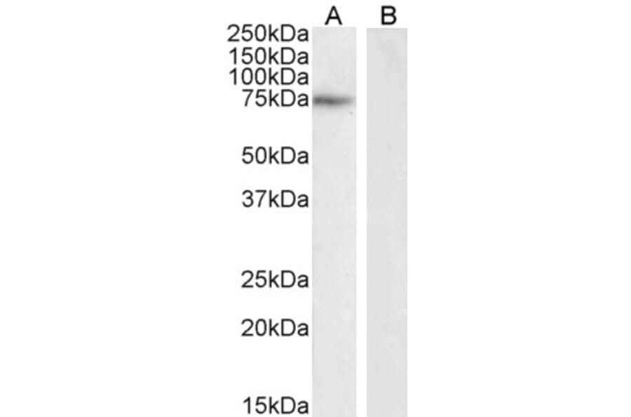 Western Blot - Anti-NOX2 Antibody (A286052) - Antibodies.com