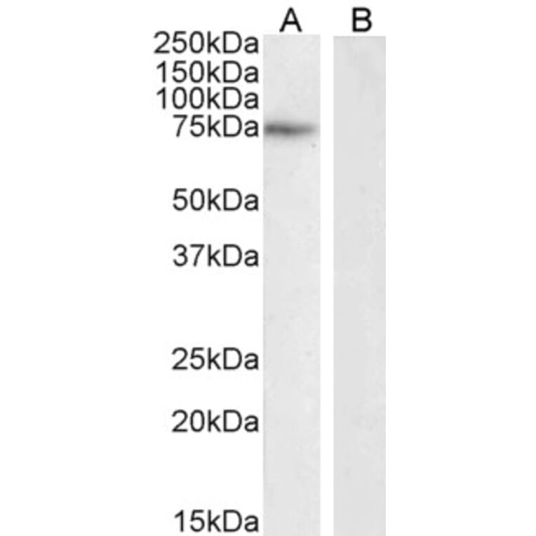 Western Blot - Anti-NOX2 Antibody (A286052) - Antibodies.com