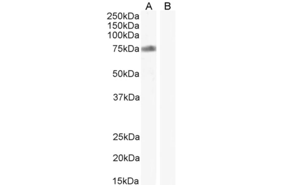Western Blot - Anti-NOX2 Antibody (A286052) - Antibodies.com