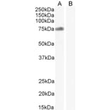 Western Blot - Anti-NOX2 Antibody (A286052) - Antibodies.com