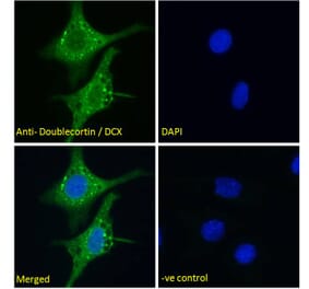 Immunofluorescence - Anti-Doublecortin Antibody (A286054) - Antibodies.com