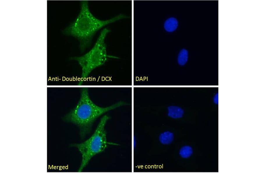 Immunofluorescence - Anti-Doublecortin Antibody (A286054) - Antibodies.com