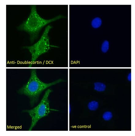 Immunofluorescence - Anti-Doublecortin Antibody (A286054) - Antibodies.com