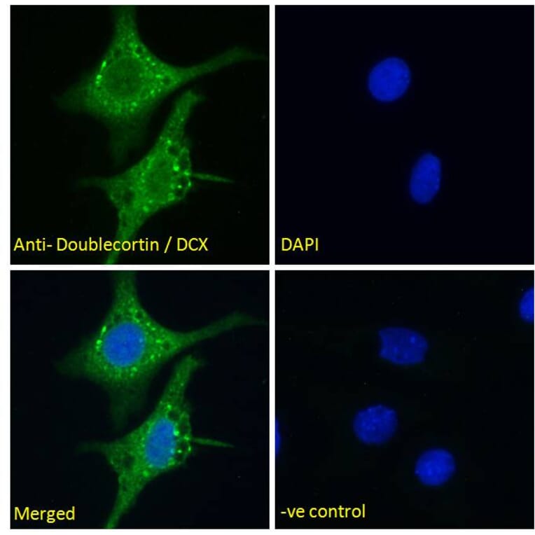 Immunofluorescence - Anti-Doublecortin Antibody (A286054) - Antibodies.com