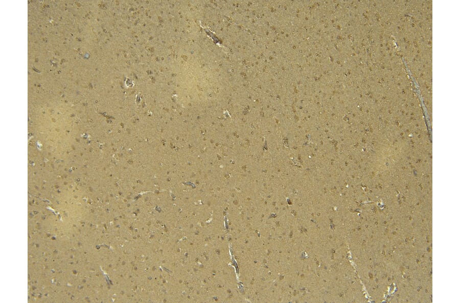 Immunohistochemistry - Anti-Doublecortin Antibody (A286054) - Antibodies.com