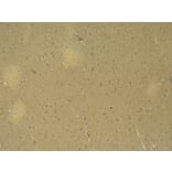Immunohistochemistry - Anti-Doublecortin Antibody (A286054) - Antibodies.com