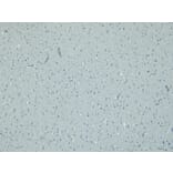Immunohistochemistry - Anti-Doublecortin Antibody (A286054) - Antibodies.com