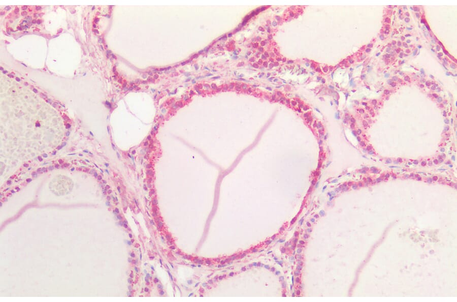 Immunohistochemistry - Anti-Notch1 Antibody (A286055) - Antibodies.com