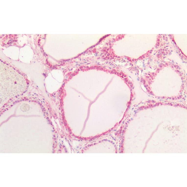 Immunohistochemistry - Anti-Notch1 Antibody (A286055) - Antibodies.com