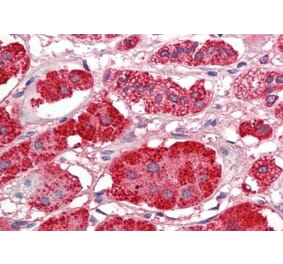 Immunohistochemistry - Anti-Acetyl Coenzyme A Carboxylase beta Antibody (A286062) - Antibodies.com