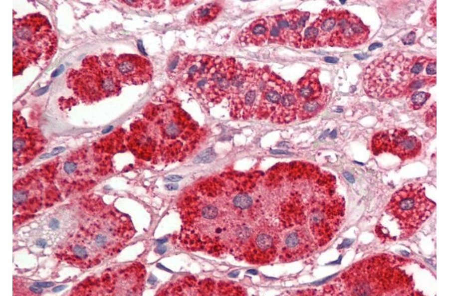 Immunohistochemistry - Anti-Acetyl Coenzyme A Carboxylase beta Antibody (A286062) - Antibodies.com