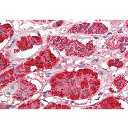 Immunohistochemistry - Anti-Acetyl Coenzyme A Carboxylase beta Antibody (A286062) - Antibodies.com