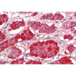 Immunohistochemistry - Anti-Acetyl Coenzyme A Carboxylase beta Antibody (A286062) - Antibodies.com