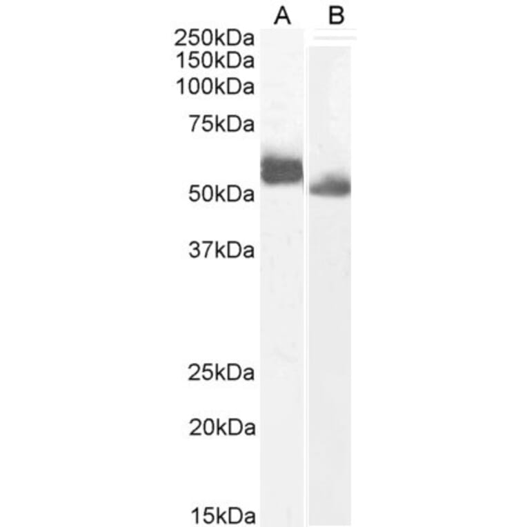 Western Blot - Anti-IRF4 Antibody (A286064) - Antibodies.com