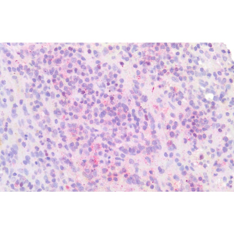 Immunohistochemistry - Anti-IRF4 Antibody (A286064) - Antibodies.com