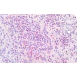 Immunohistochemistry - Anti-IRF4 Antibody (A286064) - Antibodies.com