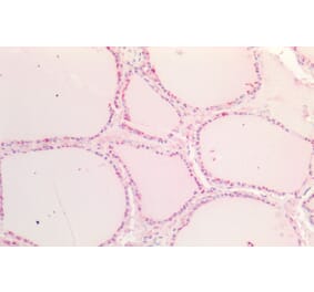 Immunohistochemistry - Anti-SOX9B Antibody (A286068) - Antibodies.com