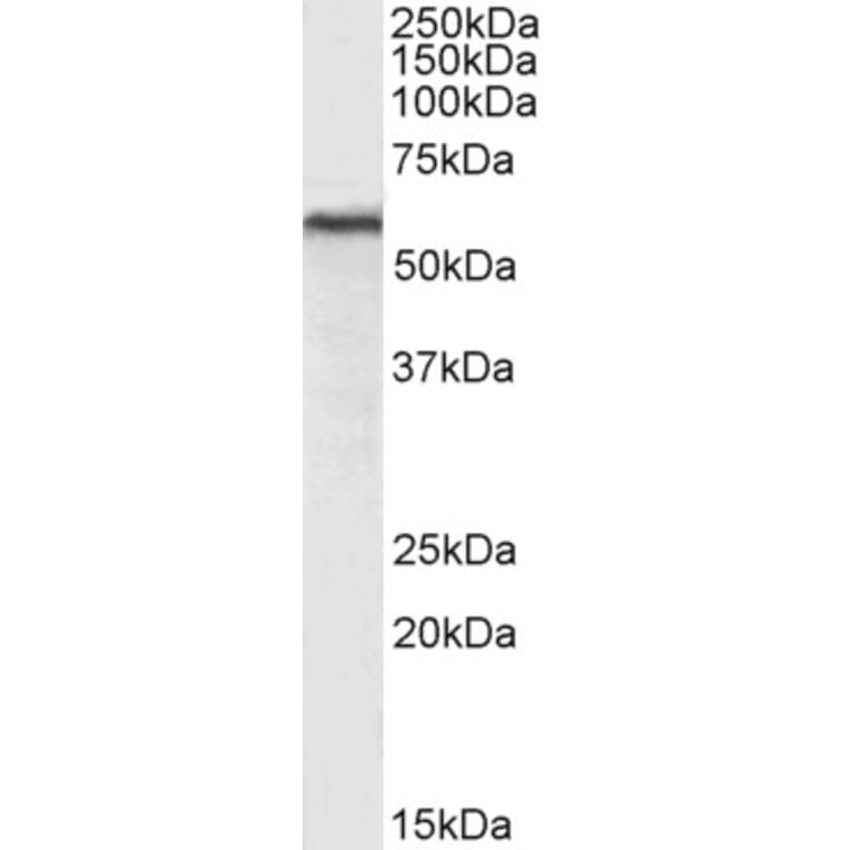 Western Blot - Anti-HDAC2 Antibody (A286069) - Antibodies.com