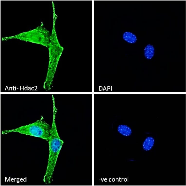 Immunofluorescence - Anti-HDAC2 Antibody (A286069) - Antibodies.com