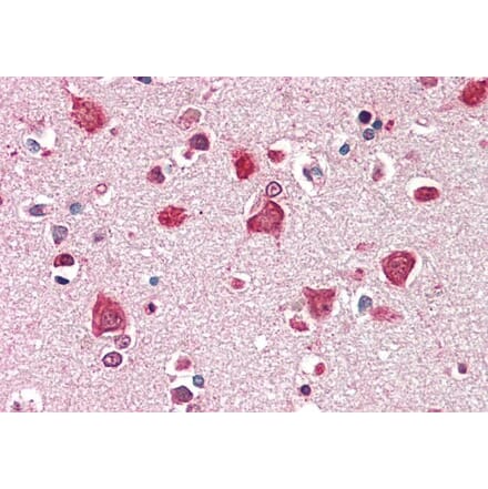 Immunohistochemistry - Anti-SDCCAG8 Antibody (A286070) - Antibodies.com