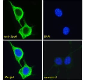 Immunofluorescence - Anti-STRA6 Antibody (A286072) - Antibodies.com