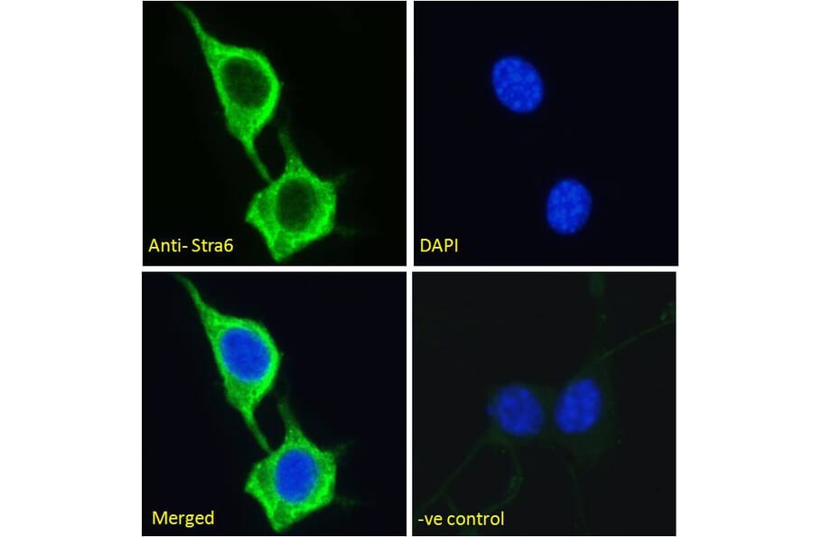 Immunofluorescence - Anti-STRA6 Antibody (A286072) - Antibodies.com