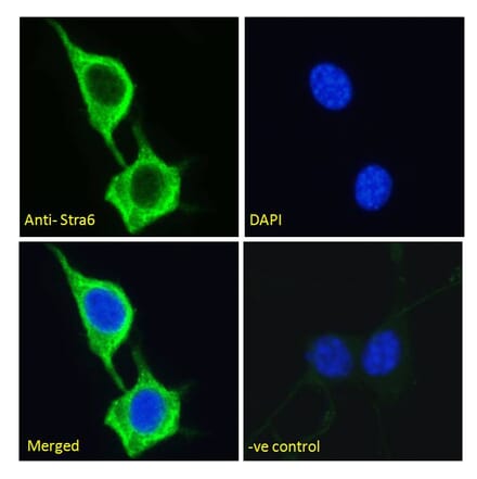 Immunofluorescence - Anti-STRA6 Antibody (A286072) - Antibodies.com
