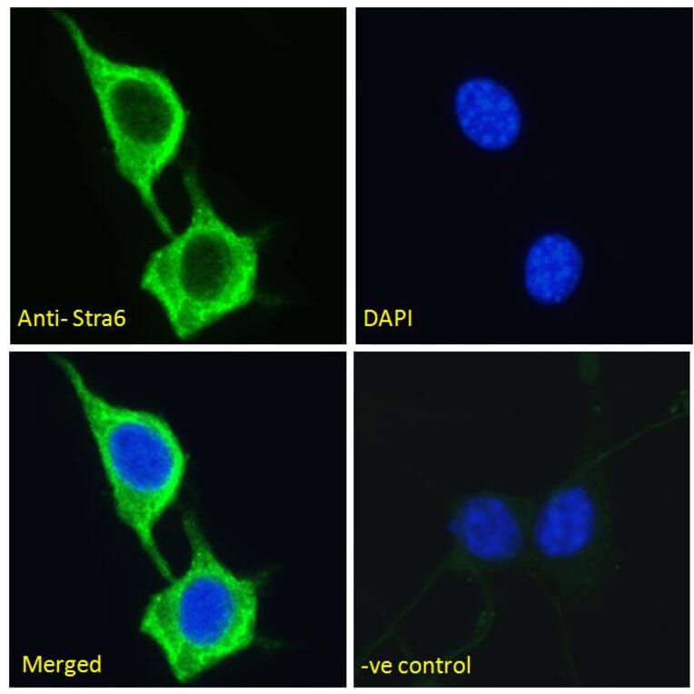 Immunofluorescence - Anti-STRA6 Antibody (A286072) - Antibodies.com