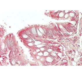 Immunohistochemistry - Anti-HE4 Antibody (A286076) - Antibodies.com