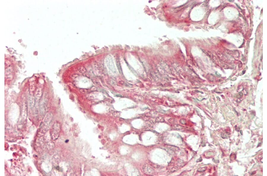 Immunohistochemistry - Anti-HE4 Antibody (A286076) - Antibodies.com