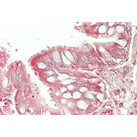 Immunohistochemistry - Anti-HE4 Antibody (A286076) - Antibodies.com