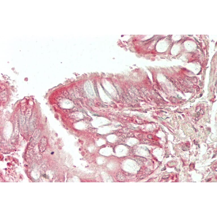 Immunohistochemistry - Anti-HE4 Antibody (A286076) - Antibodies.com