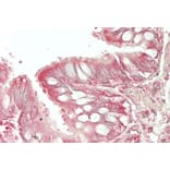 Immunohistochemistry - Anti-HE4 Antibody (A286076) - Antibodies.com