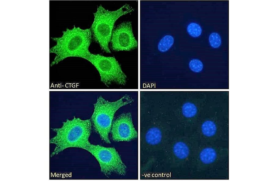 Immunofluorescence - Anti-CTGF Antibody (A286078) - Antibodies.com