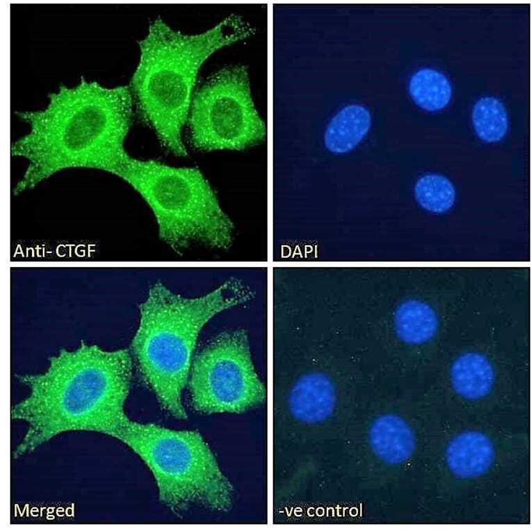 Immunofluorescence - Anti-CTGF Antibody (A286078) - Antibodies.com