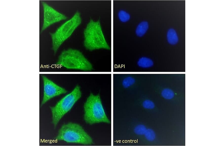 Immunofluorescence - Anti-CTGF Antibody (A286078) - Antibodies.com